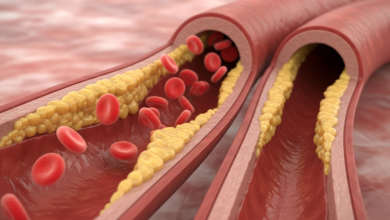 أعراض انسداد الشرايين المبكرة
