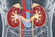 وظائف الكلى و ما هي الأعراض