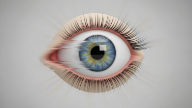 زغللة العين المفاجئة