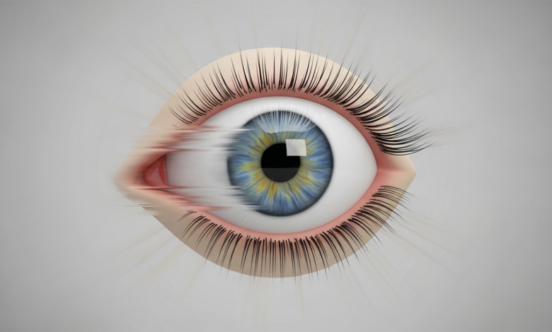 زغللة العين المفاجئة