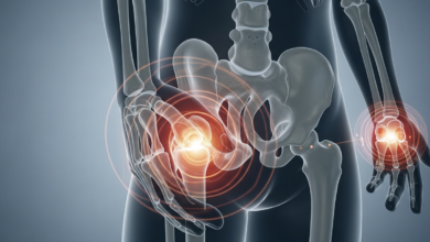 أمراض العظام والمفاصل| الأسباب والعلاج والوقاية