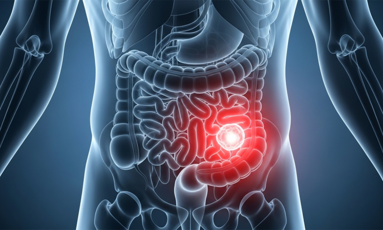أعراض سرطان القولون المبكرة