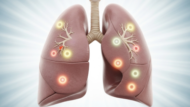 أمراض الجهاز التنفسي والرئة الأسباب والعلاج
