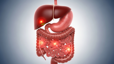 أمراض الجهاز الهضمي والكبد الأعراض والعلاج