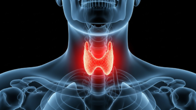 اضطرابات الغدة الدرقية