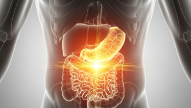 الإمساك المزمن