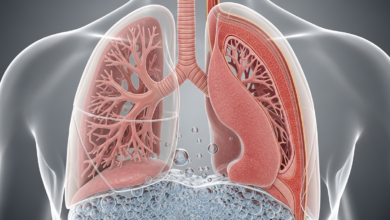 التهاب الرئة