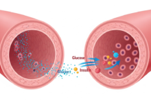 الفرق بين السكري النوع الأول والثاني