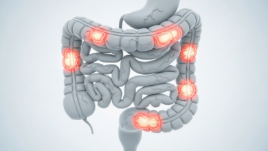 القولون العصبي