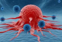 مراحل علاج السرطان